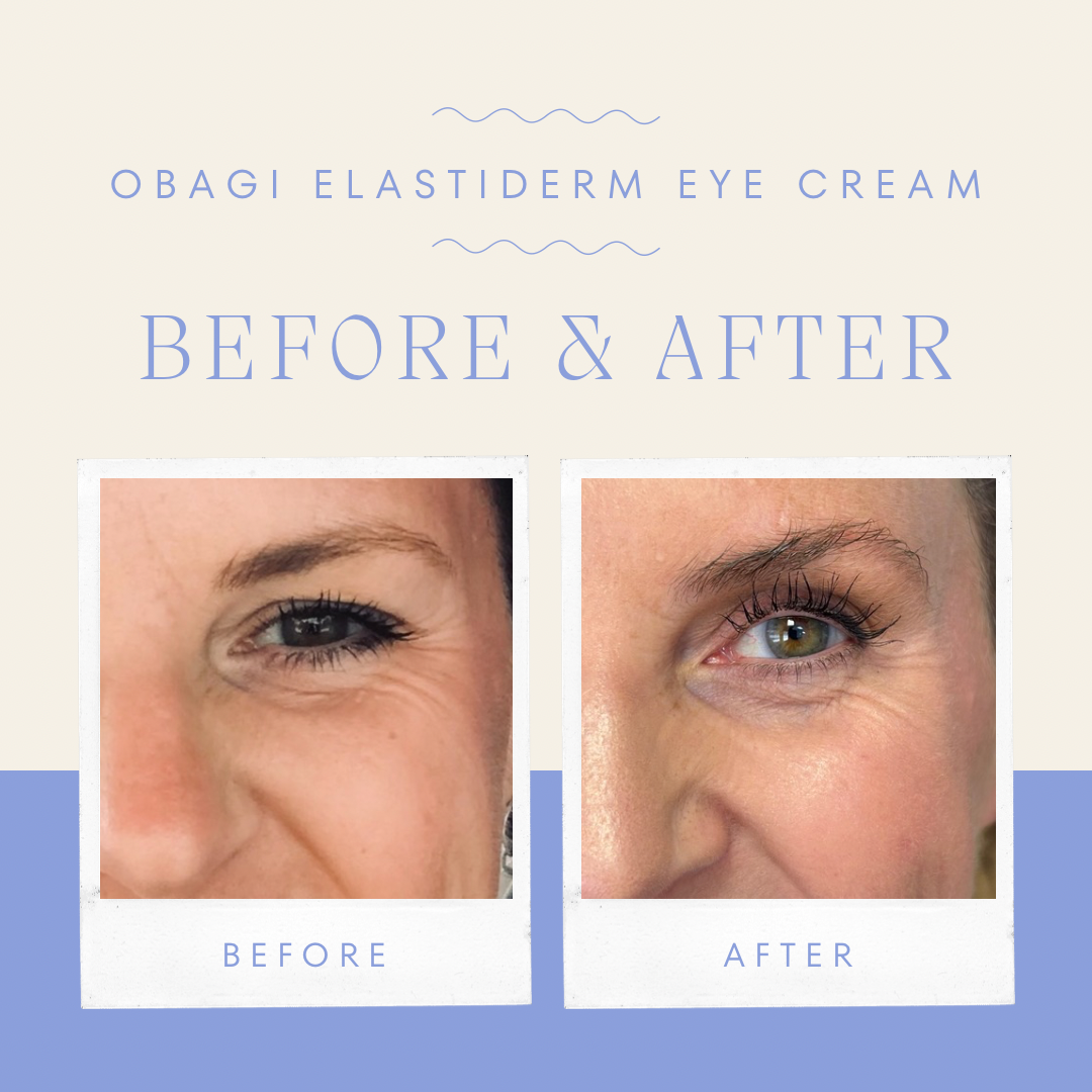 Elastiderm Eye Cream